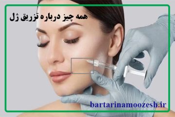 تزریق ژل چیست