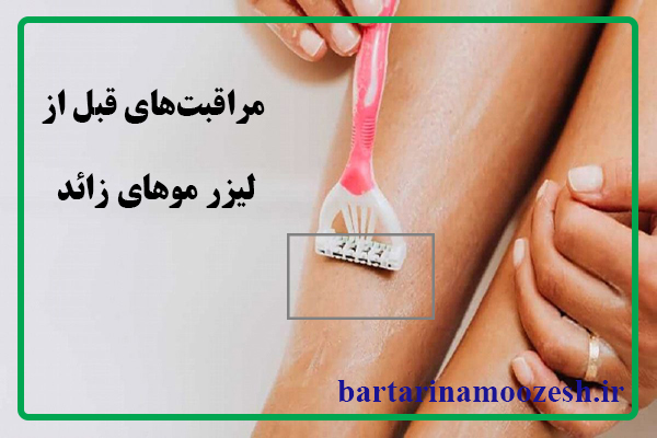 مراقبت های قبل از لیزر
