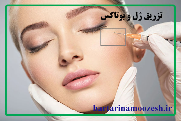 تزریق بوتاکس